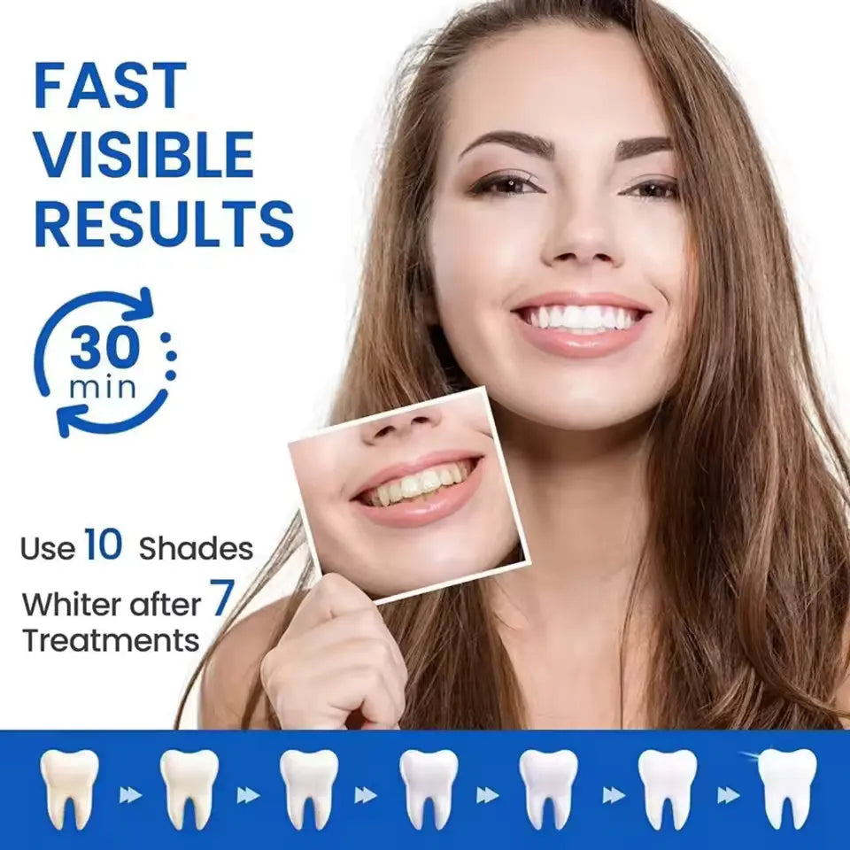 TeethBright™ - Teeth Whitening Strips